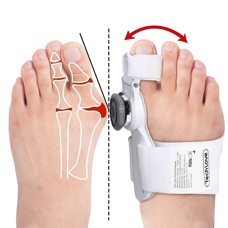 Bunion Corrector devices  Upgraded 3D Model