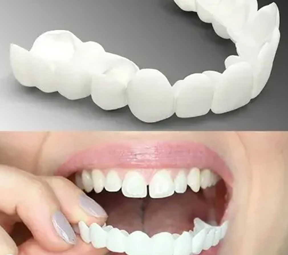 Adjustable Snap-On Dentures (Top & Bottum)