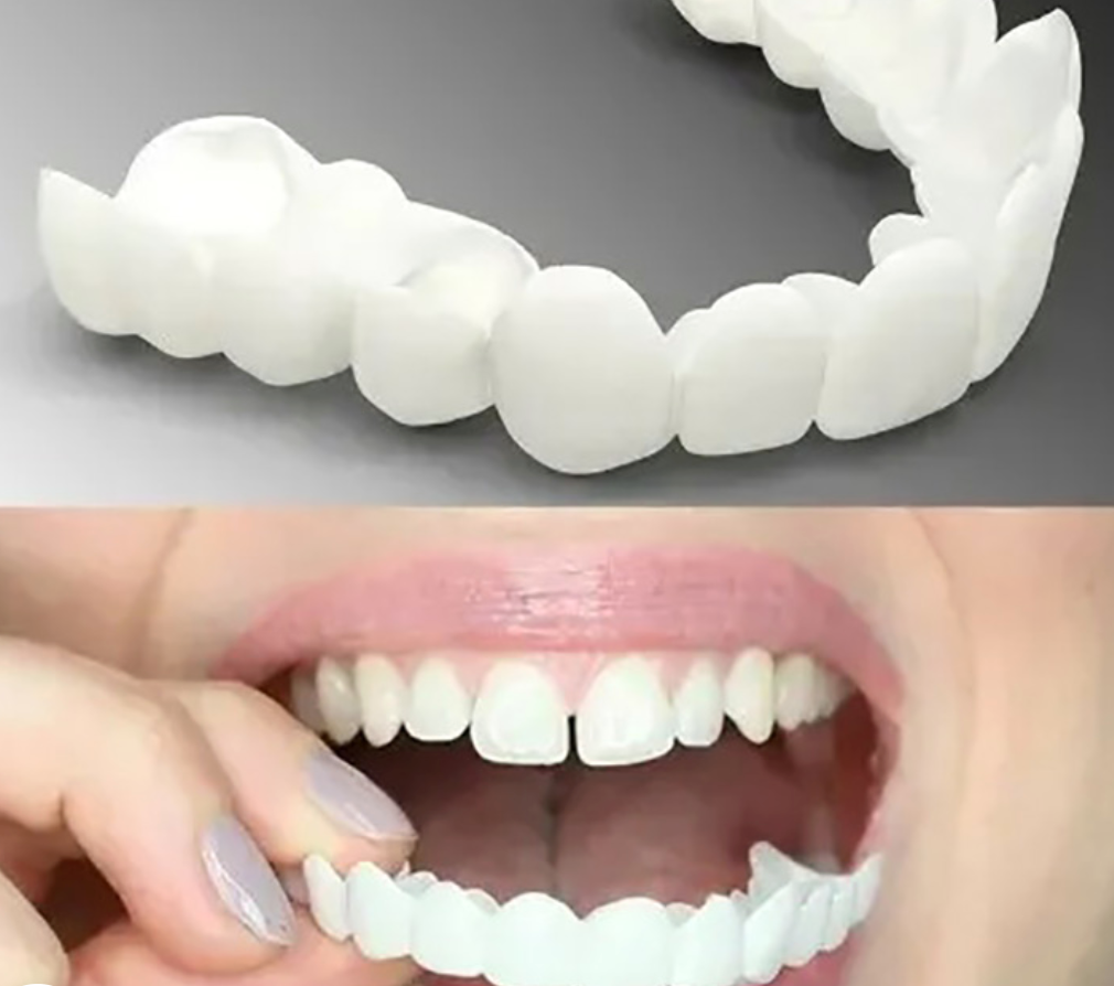 True Smile Veneers Teeth Covers-Natural white (1Pair-Upper & Lower)