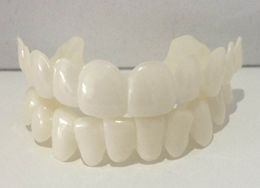 Snap on smile veneers